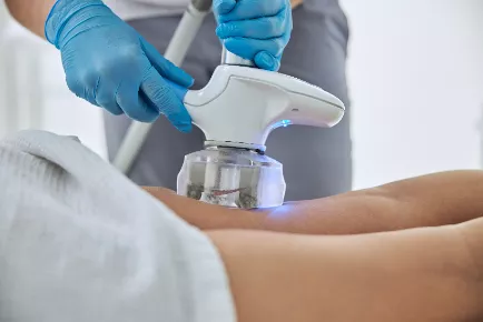 Fat Freezing (Cryolipolysis) treatments can be found at PamperTree